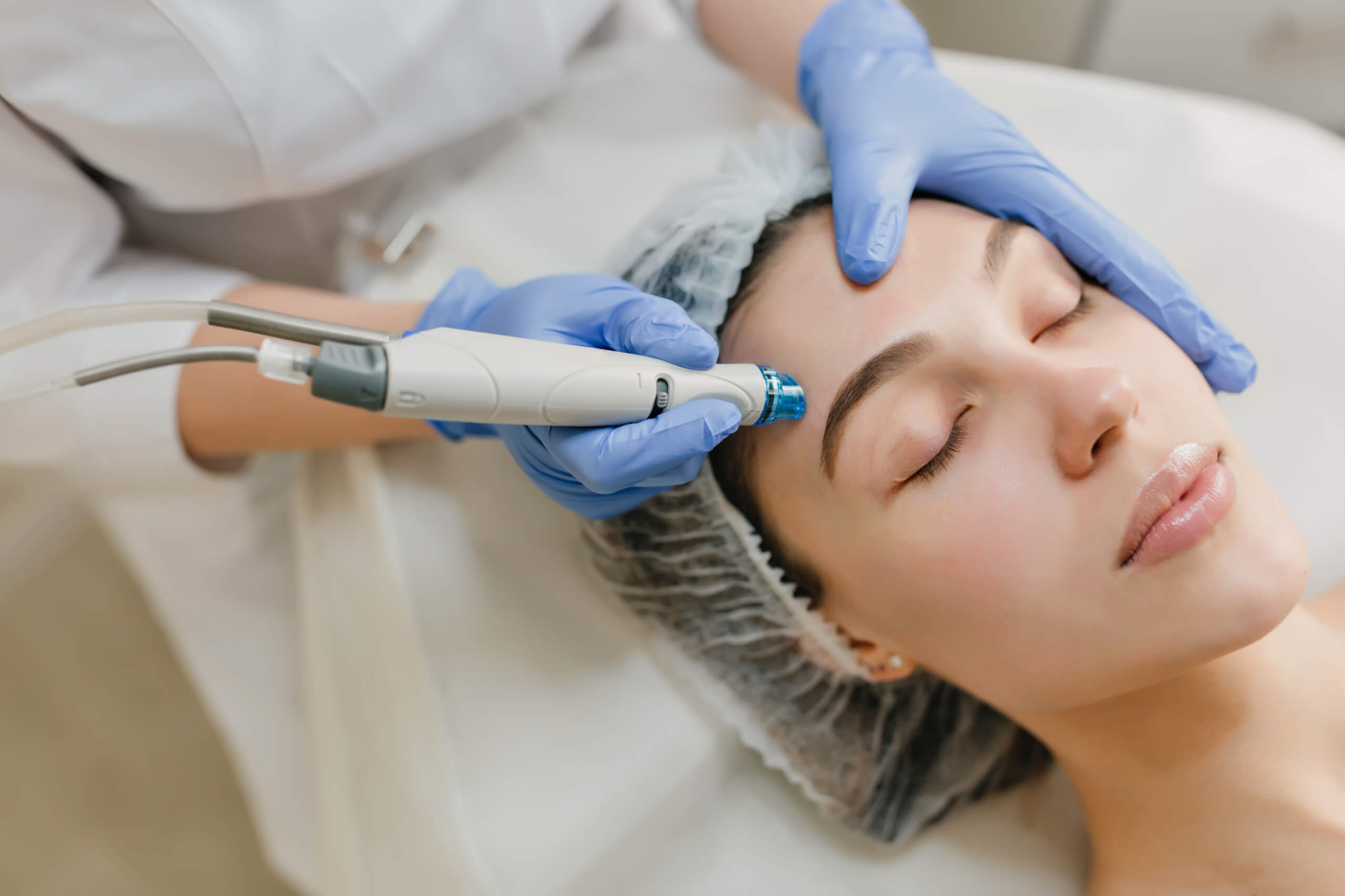 Mircrodermabrasion vs Microneedling